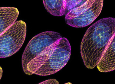 Toxoplasma gondii, a highly successful intracellular parasite, invades various cell types in all warm-blooded animals, including humans. On this image