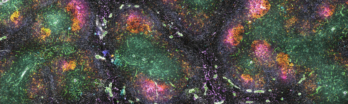 Spleen galaxy