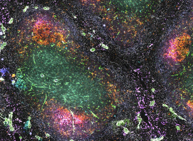 Spleen galaxy