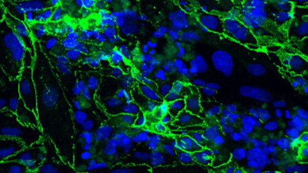 Immortalised human brain microvascular endothelial cells