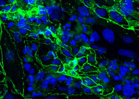 Immortalised human brain microvascular endothelial cells