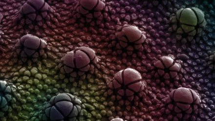 2019 Cuticle of a springtail EML.jpg