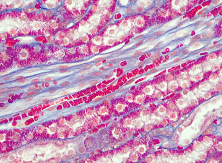 Red Blood Cells in Single File