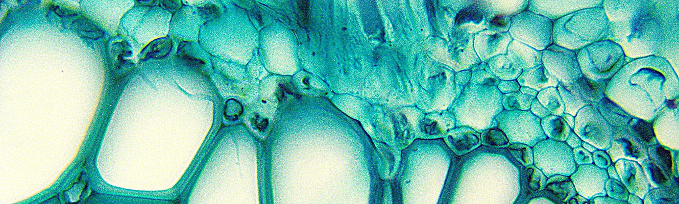 Fern Stem