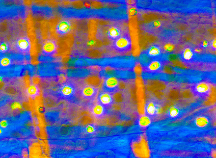 Tardigrade (Water bear) - LML