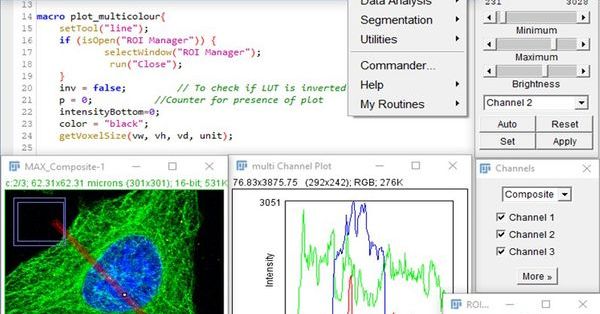 mmc series | ImageJ/Fiji Workshops